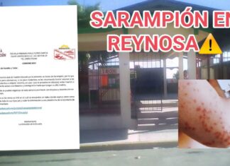 CONFIRMAN PRIMER BROTE DE SARAMPÍON EN PRIMARIA DE REYNOSA; EMITEN AVISO A PADRES DE FAMILIA.